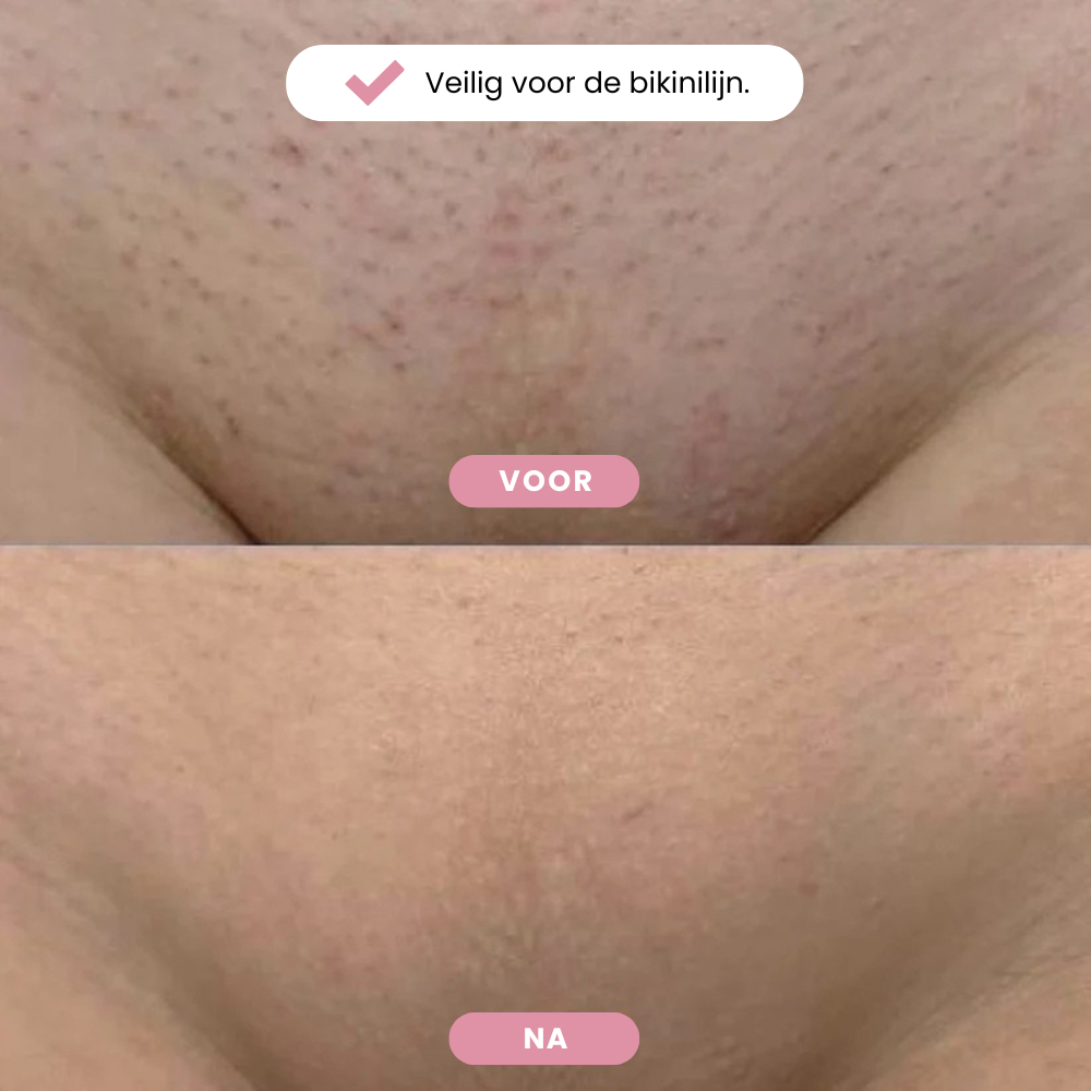 Scheermes Glizea™