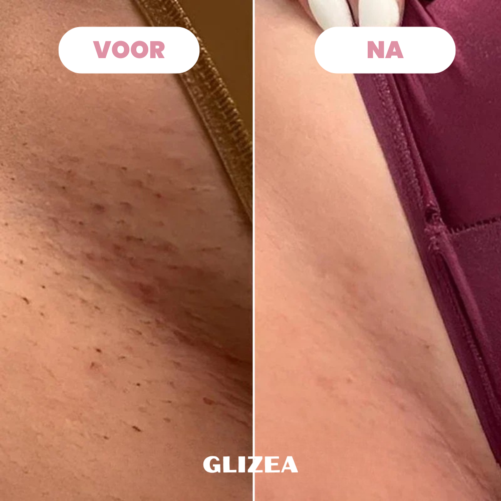 Scheermes Glizea™