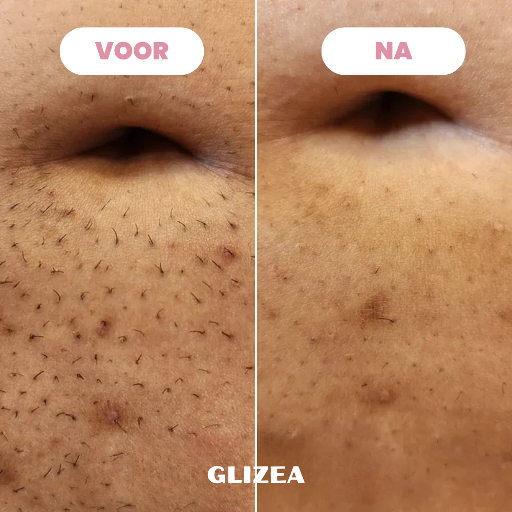 Scheermes Glizea™