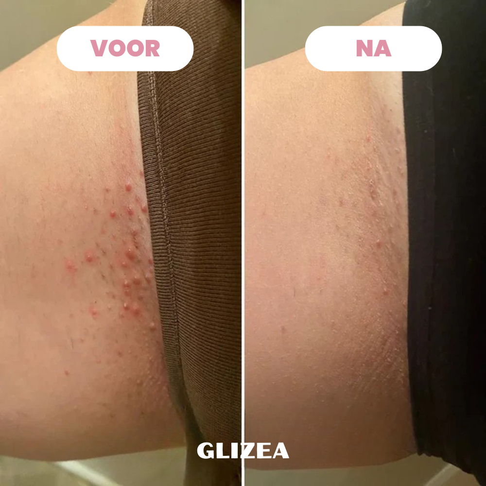Scheermes Glizea™