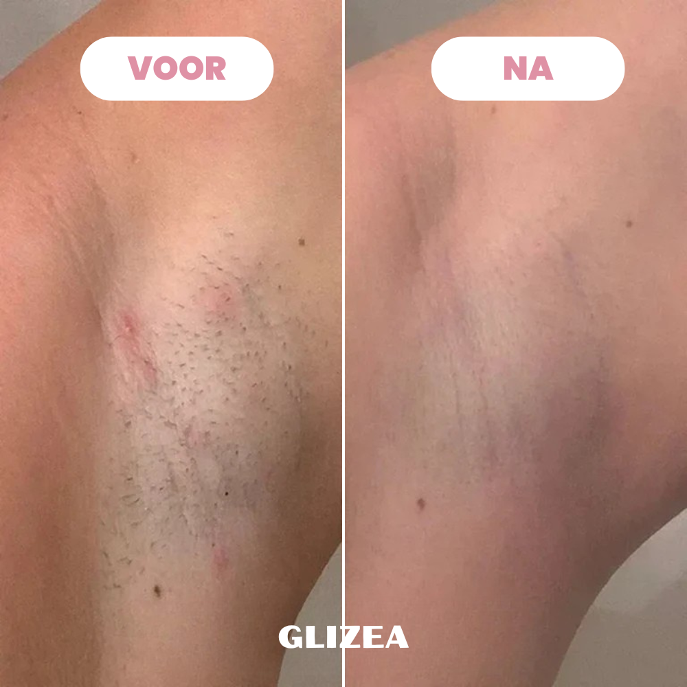 Scheermes Glizea™