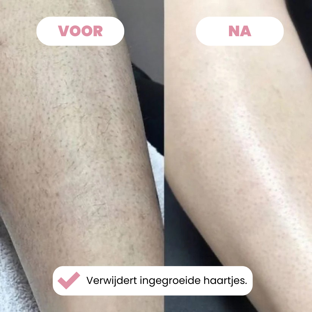 Scheermes Glizea™