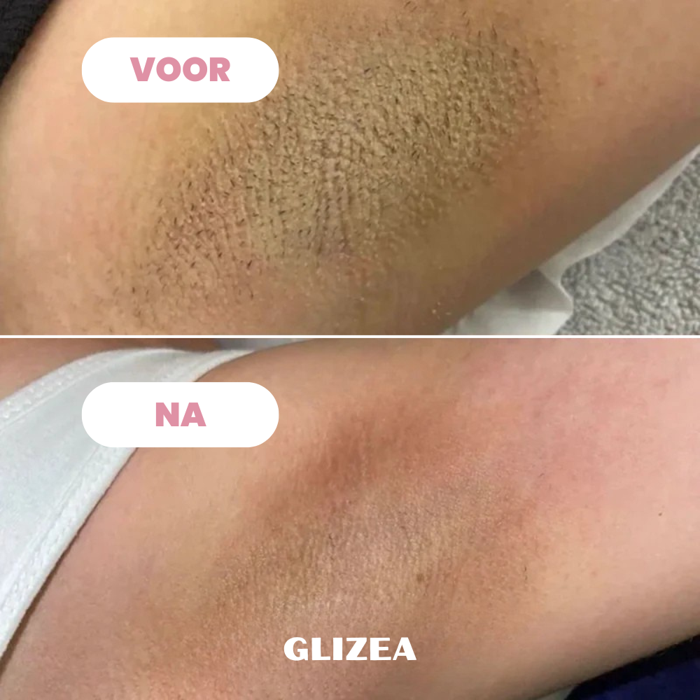 Scheermes Glizea™